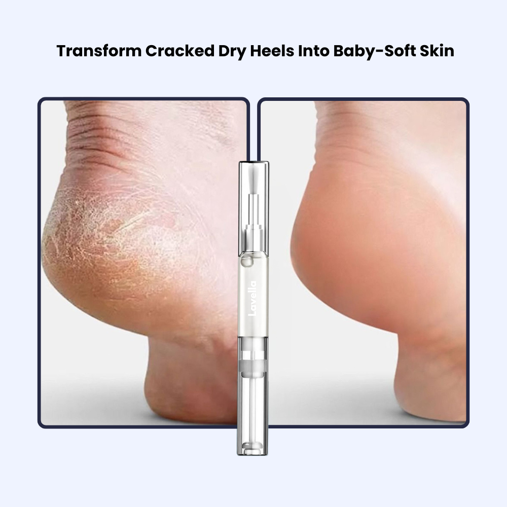Foot Fungus Relief Pen